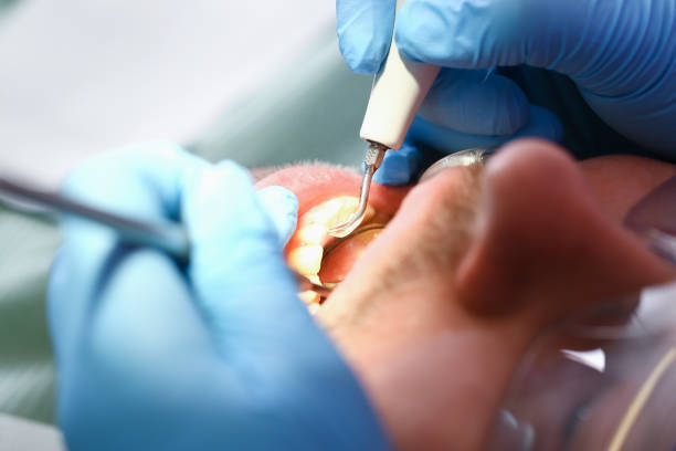 Best Walk-In Emergency Dentist in Louisburg, NC